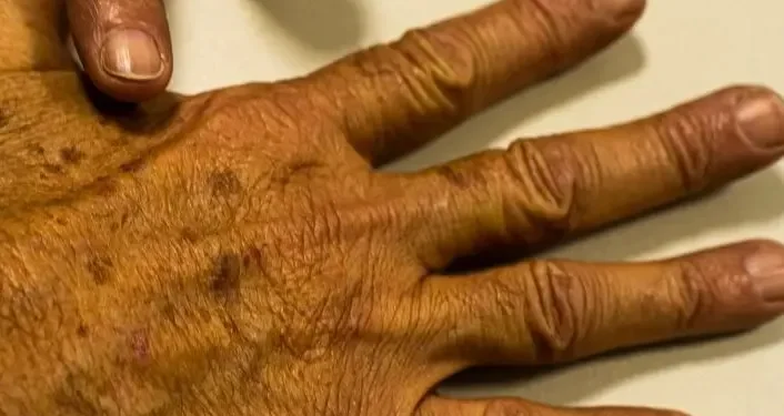 Foto: Reprodução/BAND